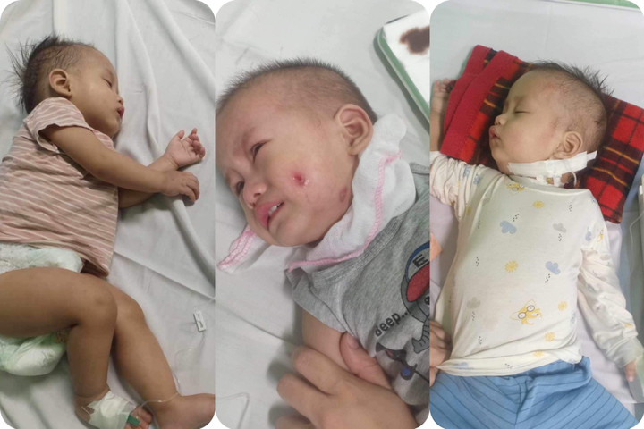 Căn bệnh làm em bị hoại tử các cơ quan trong cơ thể, nổi các.