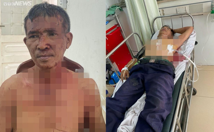 Hung thủ (trái) và nạn nhân (bên phải) đang cấp cứu tại bệnh viện.