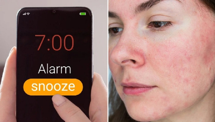 Thiếu ngủ kéo dài có thể khiến da bị kích ứng.