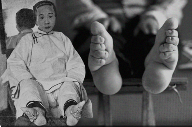 Người phụ nữ phong kiến Trung Hoa xưa cho rằng bó chân sẽ mang lại gót sen 3 tấc xinh đẹp. (Ảnh: Sohu)