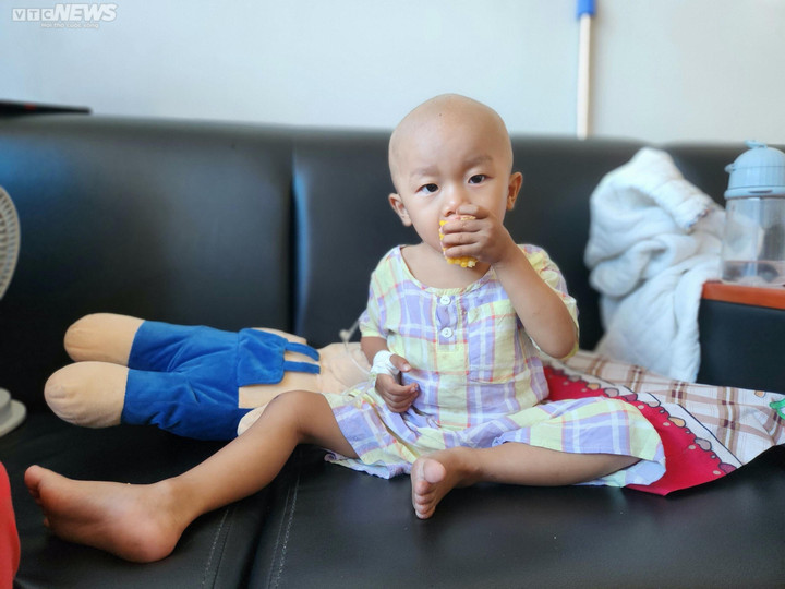 Hiện tại chân và mông của bé Trung đang bị teo lại do biến chứng của căn bệnh ung thư phúc mạc. (Ảnh: Lâm Ngọc)