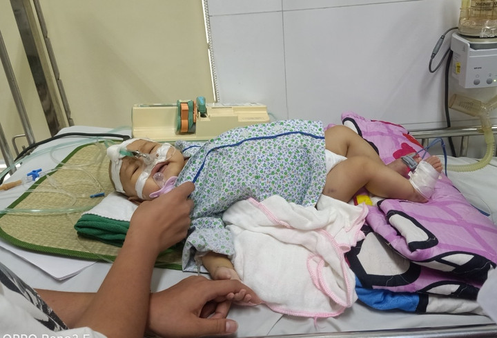 Mới 6 tháng tuổi nhưng Hải Yến đã phải trải qua nhiều cuộc phẫu thuật lớn. (Ảnh: GĐCC)