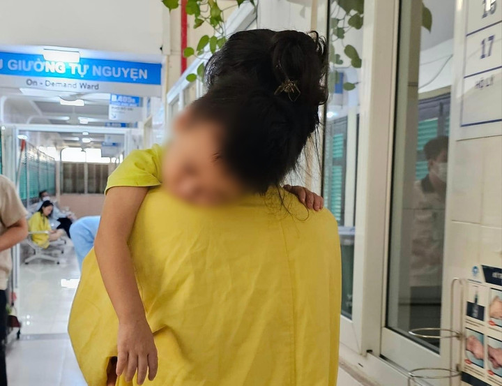 Bé L.H.Đ bị hoại tử một bên mắt sau khi bóc giả mạc tại Bệnh viện Mắt Hà Nội 2. (Ảnh: GĐCC)