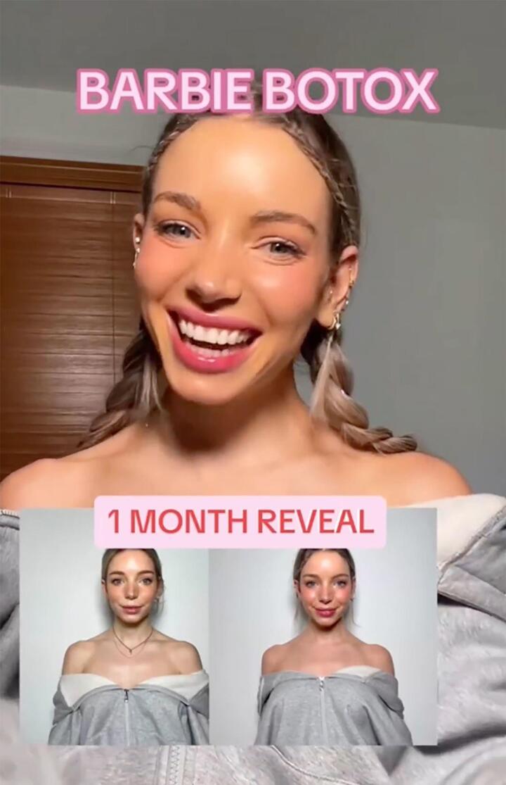 Isabelle Lux tiêm Botox để có được bờ vai thon thả và chiếc cổ thon dài như búp bê Barbie. (Ảnh: TikTok)
