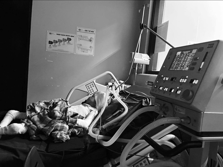 Kem đang điều trị tại khoa Điều trị tích cực- Bệnh viện Nhi Trung ương. (Ảnh: NVCC)