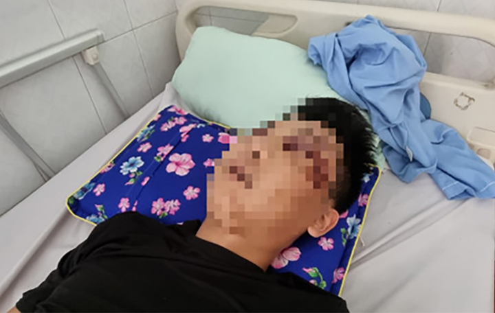 Hiện anh Sơn vẫn trong tình trạng lơ mơ, không tỉnh táo.