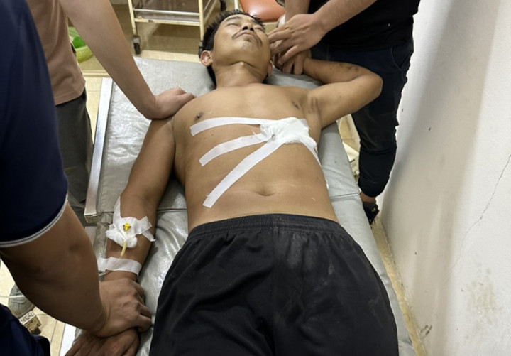 Đối tượng Tạ Sỹ Trường đang được cấp cứu tại trung tâm y tế.