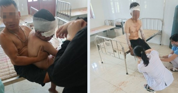 Hai người bị bỏng đã được đưa đi cấp cứu. (Ảnh: Công an TP Hải Phòng).