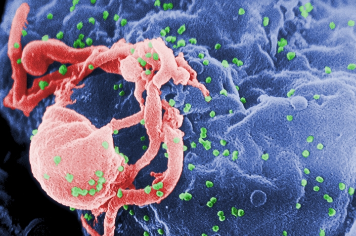 Thuốc venetoclax cho thấy nhiều hứa hẹn trong phương pháp điều trị HIV. (Ảnh minh họa)