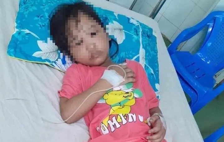 Bị ong vò vẽ đốt, người mẹ hôn mê và 3 con thương tích nặng - 2