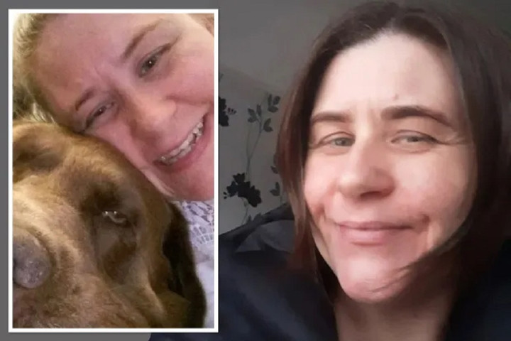 Marie Stevens - người bị hai con chó Rottweiler tấn công chiều 18/8. (Ảnh: The Sun)