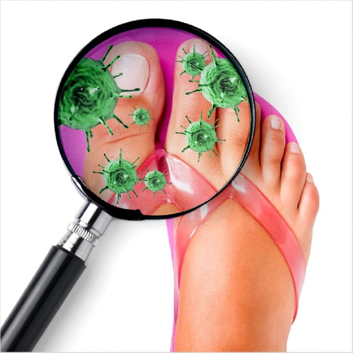 Nhiễm khuẩn, nấm ở chân là một trong những tác hại khi thường xuyên đi dép xỏ ngón.