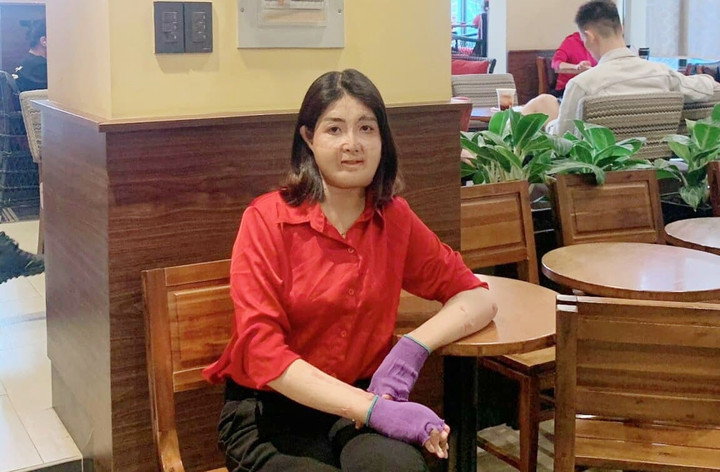 Sau biến cố, cuộc sống hiện giờ của chị ổn định hơn trước. (Anh: NVCC)