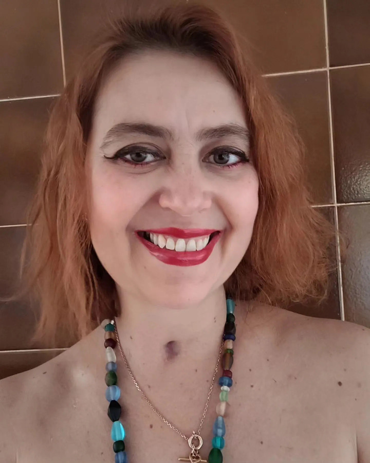 Doralice Carneiro Sobreira Goes trước khi bị ngộ độc. (Ảnh: NYP)