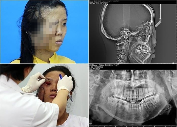Các chuyên gia đánh giá đây là ca bệnh khó, thử thách đối với y học.