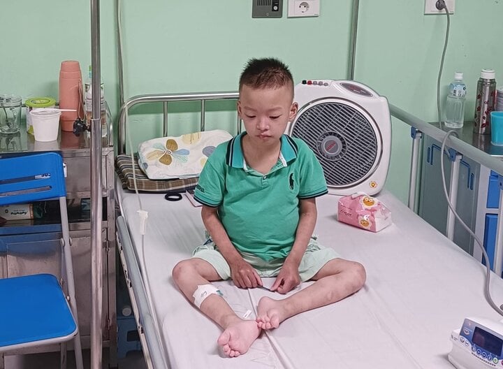 Hiện Quang đang phải điều trị tại Bệnh viện Nhi Trung ương.