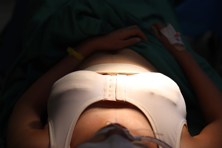 Nâng ngực bị sẹo, nguyên nhân do đâu? - 1