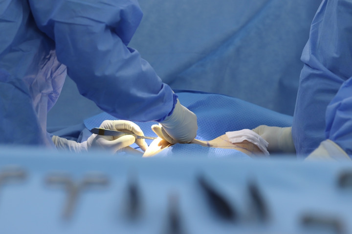 Nâng ngực bị sẹo, nguyên nhân do đâu? - 4