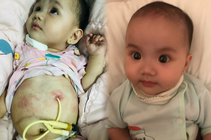 Trải qua một lần mổ dị tật thực quản nhưng hiện tại sức khoẻ của Luyến rất yếu.