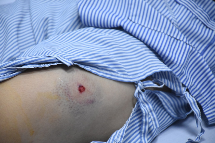 Hai nữ lao công bị bắn đang nằm điều trị tại bệnh viện. (Ảnh: B.V)