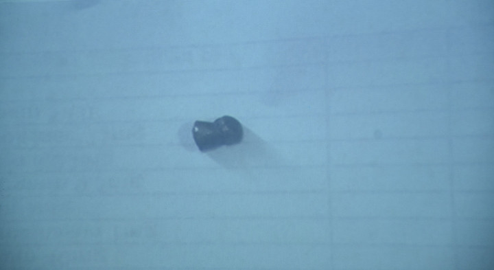 Viên đạn lấy từ đùi của nữ lao công. (Ảnh: B.V)