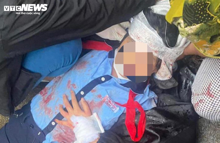 Nữ sinh N. chấn thương nặng sau khi bị gã thanh niên cùng xóm dùng búa đánh vào đầu. (Ảnh: CTV)