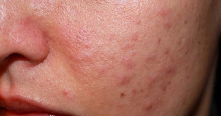 Mua nhầm mỹ phẩm kém chất lượng tiềm ẩn nhiều nguy cơ về sức khỏe.