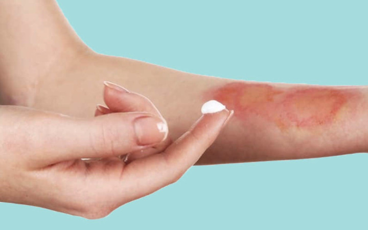 Panthenol trong mỹ phẩm giúp giảm viêm, hồi phục màng bảo vệ.