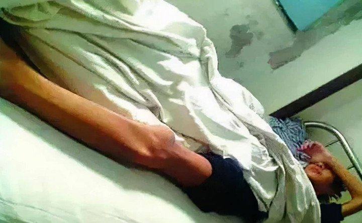 Vương Thượng Côn gầy trơ xương.