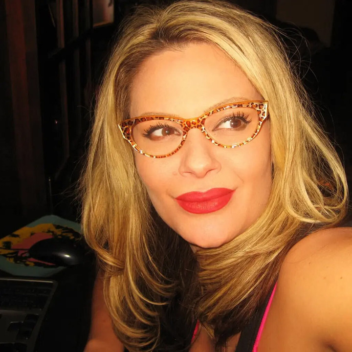 Khuôn mặt của Carson khi chưa bị hoại tử mũi.