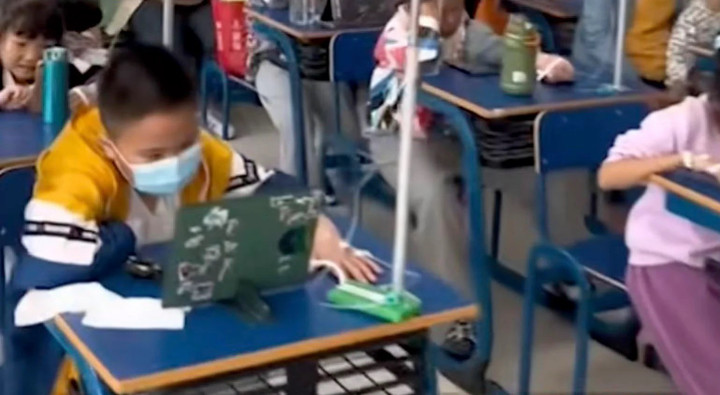 Đang truyền dịch vẫn phải ngồi làm bài tập về nhà. (Ảnh: Douyin)