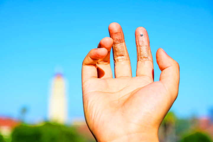 Công nghệ cấy ghép da tiết insulin đẩy lùi bệnh tiểu đường thành công ở chuột. (Ảnh minh họa: techexplorist)