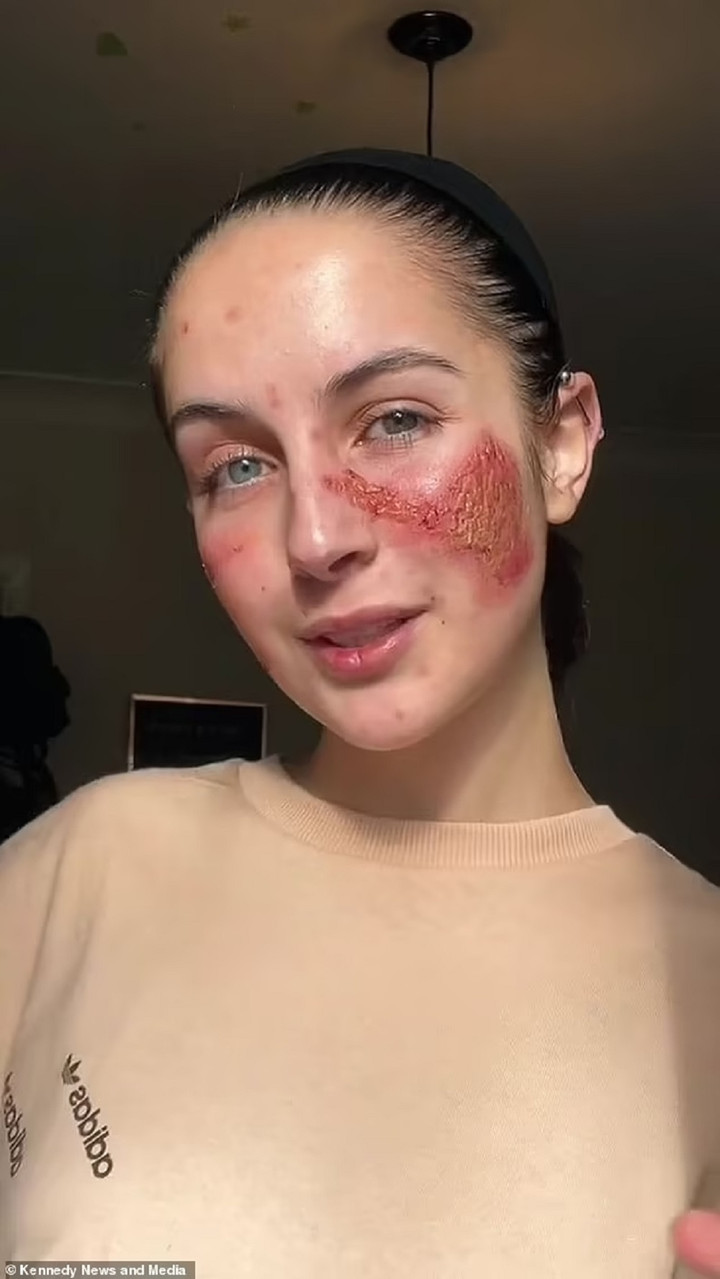 Cô gái 21 tuổi đã tự tin hơn rất nhiều về vẻ ngoài của mình. (Ảnh: Daily Mail)