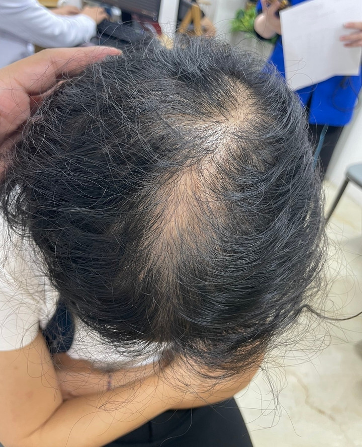 Trào lưu 'No Poo' khiến dân mạng tranh cãi, chuyên gia nói gì? - 6