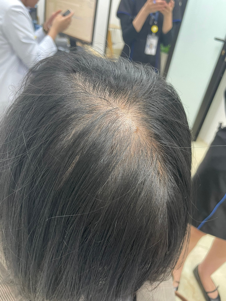 Trào lưu 'No Poo' khiến dân mạng tranh cãi, chuyên gia nói gì? - 5