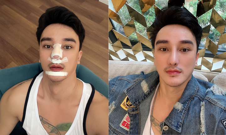 Hà Nhuận Nam cảm thấy may mắn vì mặc dù sửa đi chỉnh lại nhiều lần, nhưng gương mặt vẫn còn chút tự nhiên.