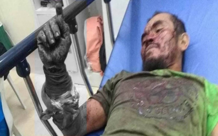 Bolijulio Aleri được đưa vào bệnh viện trong tình trạng nguy kịch.