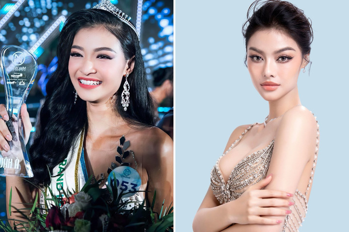 Hình ảnh của hoa hậu Loan Lona trước và sau khi sử dụng phương pháp nâng ngực nội soi, nâng mũi, cắt mắt tại bệnh viện thẩm mỹ Việt Mỹ.