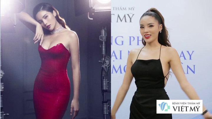 Hoa hậu Kỳ Duyên sau khi hút mỡ siêu âm Lipo Ultrasound.