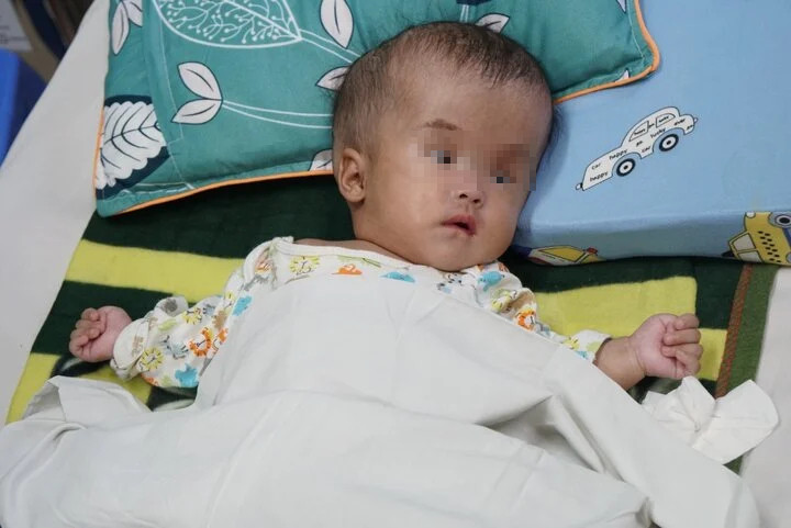 Ngọc Phương bị giãn não thất, thoát vị tuỷ - mảng tuỷ. (Ảnh: Nguyễn Ngoan)