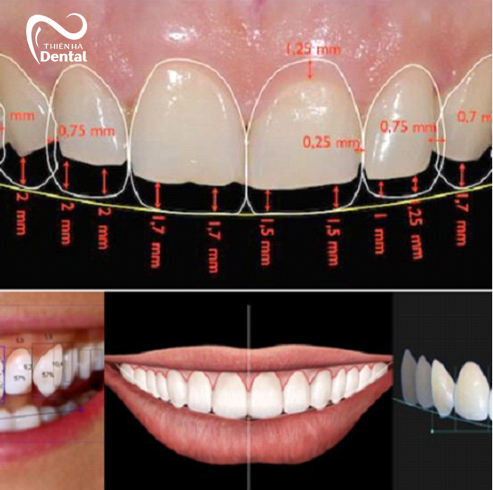 Được trải nghiệm nụ cười mới trước khi làm.