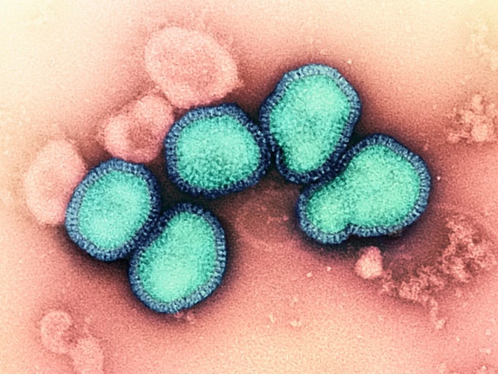 Virus H3N2 dưới kính hiển vi. (Ảnh: NIAID)