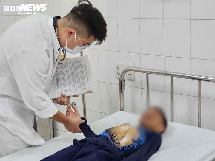 Bác sĩ đang kiểm tra sức khoẻ cho 1 trong 4 bệnh nhi bị bỏng nặng do nghịch pháo không rõ nguồn gốc. (Ảnh: Mai Trang)