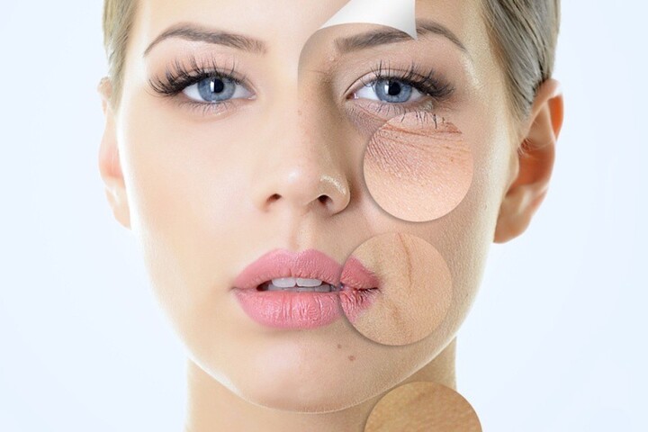 Thiếu collagen sẽ làm da bạn lão hoá sớm.