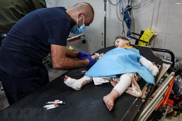 Điều trị cho em nhỏ bị thương trong xung đột Israel-Hamas tại bệnh viện Nasser ở Khan Yunis, phía Nam Dải Gaza, ngày 20/11/2023. (Ảnh: AFP/TTXVN)