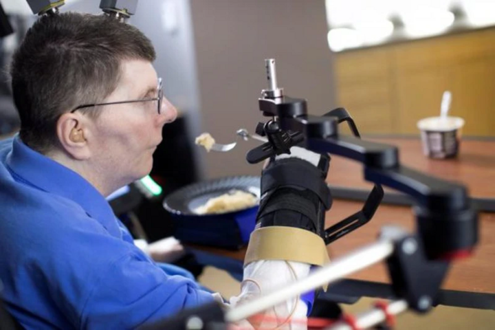 Người đàn ông điều khiển cánh tay bị liệt nhờ công nghệ giao diện não - máy tính. (Ảnh: Reuters)