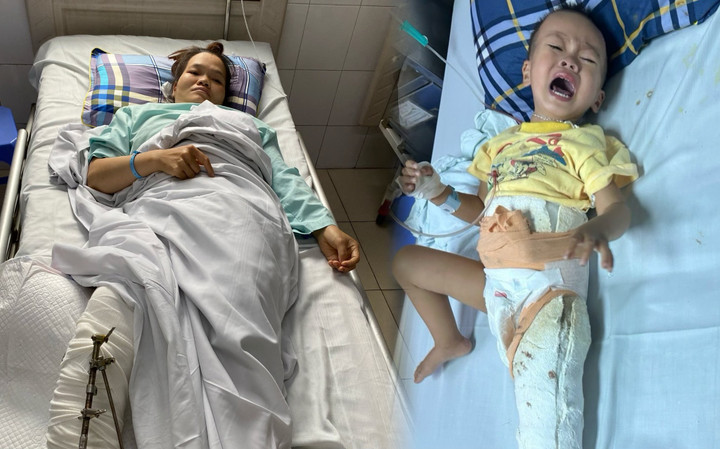 Chị Hương cùng con bị xe tải cán qua chân.