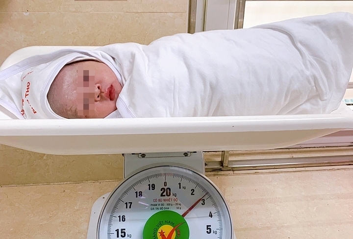Em bé có 5 vòng dây rốn quấn cổ "hiếm gặp" chào đời an toàn. (Ảnh: BVCC)