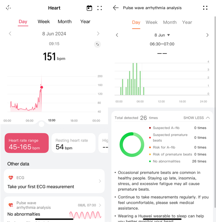 Huawei Watch Fit 3 tự động phân tích và theo dõi các bất thường về nhịp tim.