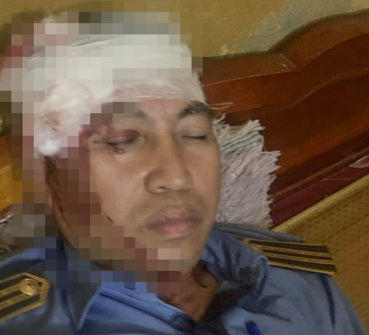 Lái phụ tàu hàng bị trọng thương. (Ảnh: VNR)